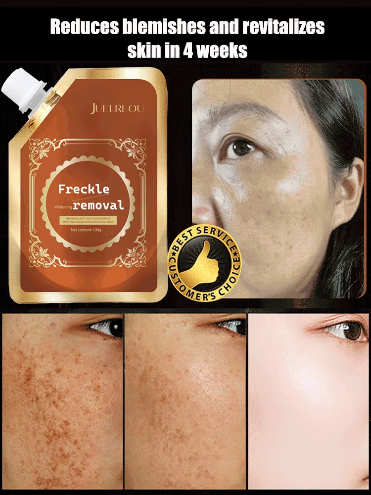 💥Big Discount Today - 2024 New Anti-Blemish & Anti-Aging & Anti-Wrinkle Tear-Off Mask (Clinically Certified)